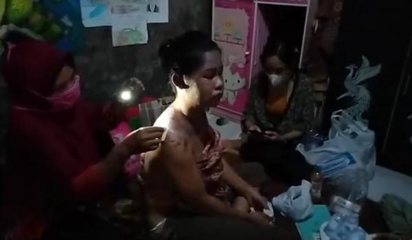 Waria Disiram2 Waria di Cilegon disiram minyak panas oleh pacarnya. (Foto: iNews/Iskandar Nasution)