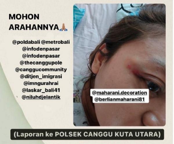 BM, perempuan asal Bandung, Jawa Barat korban penganiayaan dan pemerasan pria Nigeria, Koffi Christian Yao.