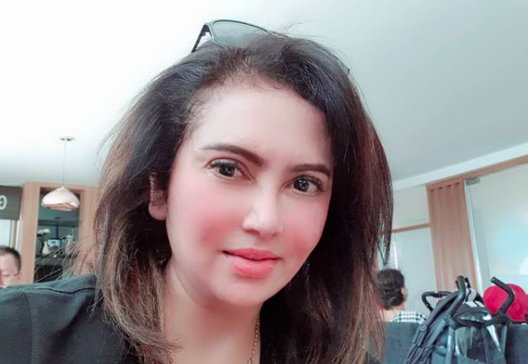 Selebritis alami pendarahan otak yang kini diderita Tukul Arwana. (Foto: Instagram)