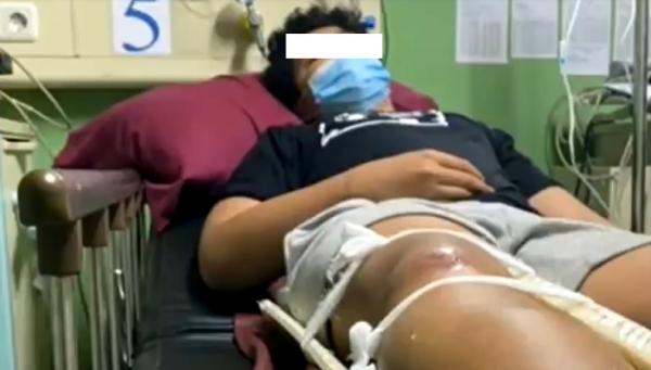 Korban penganiyaan diduga oknum polisi Remaja di Bali mengaku diinjak dan disetrum hingga patah kaki oleh oknum polisi. (Foto: iNews/Muhyiddin)