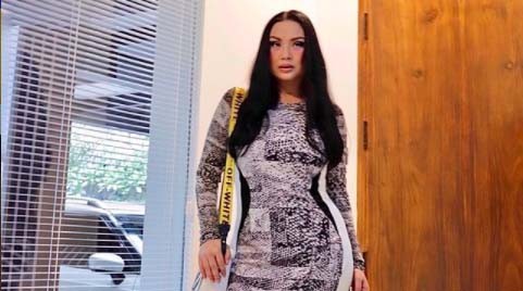 Artis operasi plastik di 2023. (foto: instagram)