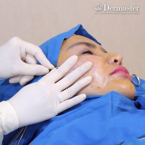 (Foto: Dermaster Indonesia)