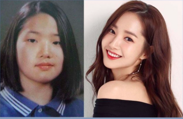 Artis Korea ngaku operasi plastik sejak masih remaja. (Foto: Instagram)
