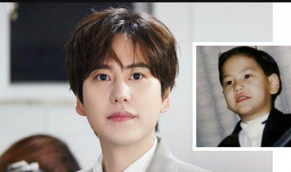 artis Korea ngaku operasi plastik sejak masih remaja. (Foto: Instagram)