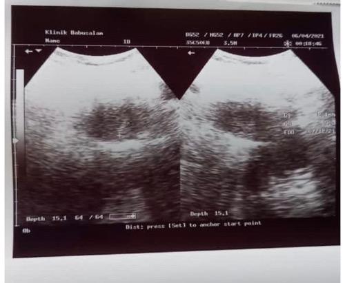 Hasil USG Jessica Iskandar. (Foto: IG)