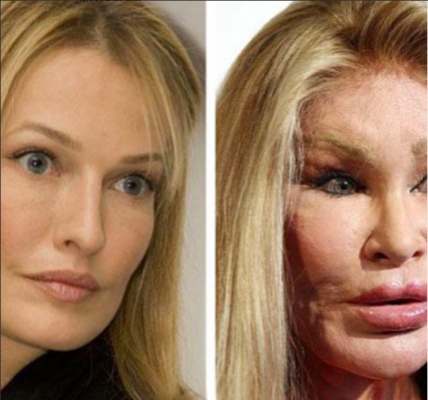 Screen Shot 2021 12 10 At 11 26 22 Deretan artis gagal operasi plastik. (Foto: Instagram)