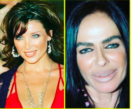 Deretan artis gagal operasi plastik. (Foto: Instagram)