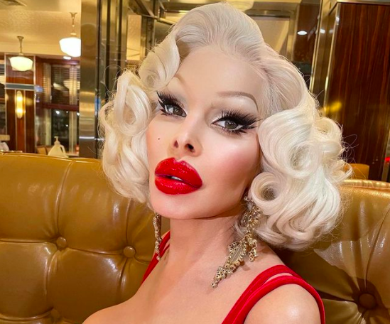 Deretan artis gagal operasi plastik. (Foto: Instagram)