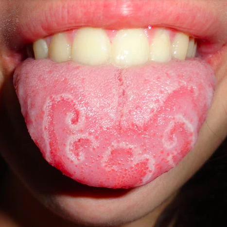 Penyakit teraneh di dunia hingga kini belum ditemukan obat. (Foto: Instagram)