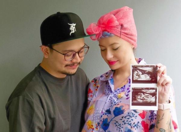 Claudia Adinda istri Derby Romero akan melahirkan di tahun 2022.