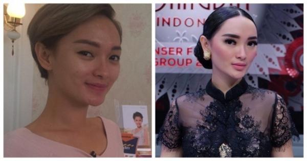 WhatsApp Image 2022 01 06 At 4 23 02 PM Deretan artis ini melakukan perawatan wajah tanam benang. (Foto: Instagram)