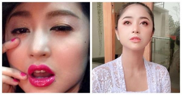 WhatsApp Image 2022 01 06 At 4 23 04 PM Deretan artis ini melakukan perawatan wajah tanam benang. (Foto: Instagram)