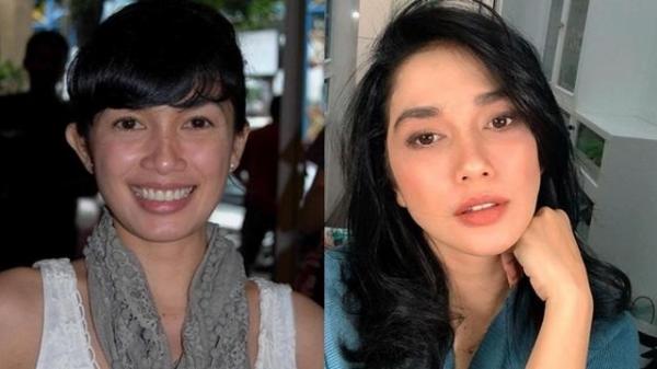 WhatsApp Image 2022 01 06 At 4 23 05 PM 1 Deretan artis ini melakukan perawatan wajah tanam benang. (Foto: Instagram)