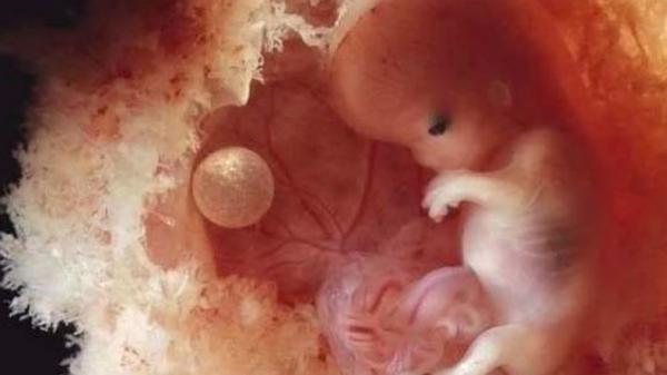 Arti tendangan janin selama kehamilan, janin mencari posisi nyama (Foto: Ilustrasi/Ist). (Foto: Ist.)