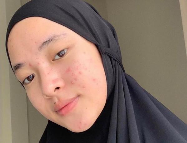 Nissa Sabyan lagi bareface 7 wajah asli artis ini beda banget dari aslinya, Nissa Sabyan. (Foto: IG)