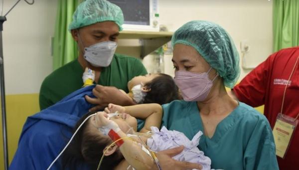 Operasi pemisahan anak kembar siam Joana dan Jovalin di RSUP Prof RD Kandaou, Manado, Sulawesi Utara berlangsung selama 10 jam. (Foto: Dispenad)