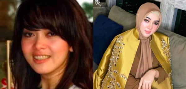Artis Mengalami Perubahan Wajah Drastis. (Foto: istimewa)