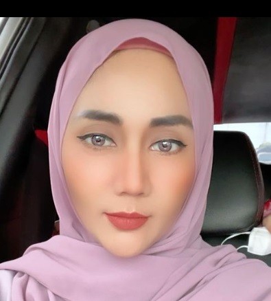 Artis Indonesia yang Tengah Berjuang Melawan Penyakit Mematikan. (Foto: Instagram)