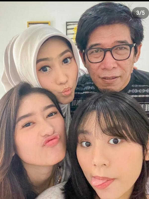 Paras Cantik Anak Komedian Terkenal yang Jarang Tersorot Media. (Foto: instagram)
