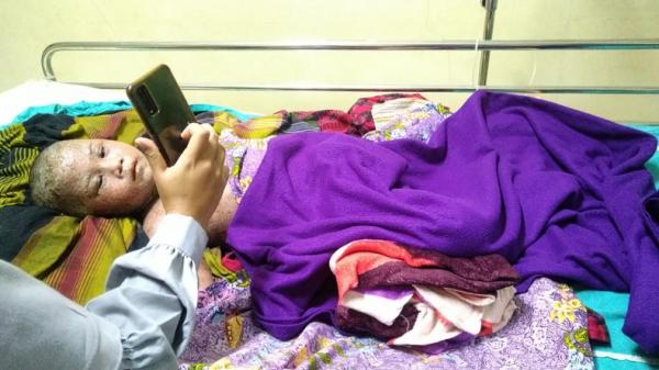 KAISYYA PENDERITA AUTOIMUN CIAMIS Kaisyya menonton film kartun yang diputarkan ibunya Sifa Fauziah di handphone. (FOTO: iNews/ACEP MUSLIM)