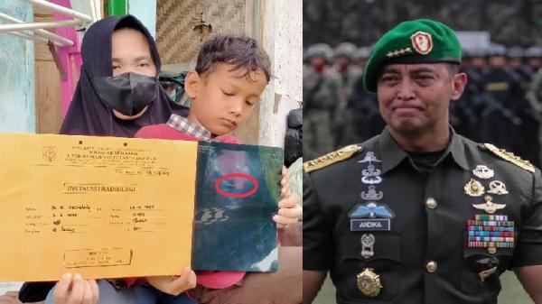 Panglima TNI Jenderal Andika Perkasa Bantu Operasi Bocah Indramayu yang Telan Kunci