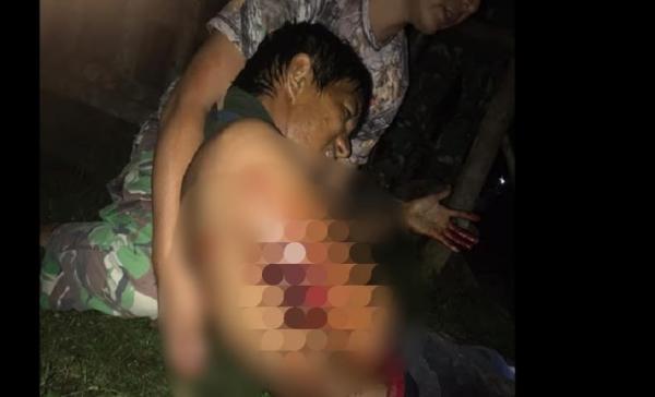 WhatsApp Image 2022 09 30 At 6 56 02 AM Pekerja terkena tembakan OTK. (Foto: iNews/Chanry Andrew)