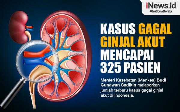 Infografis Kasus Gagal Ginjal Akut Di Indonesia Capai 325 Orang