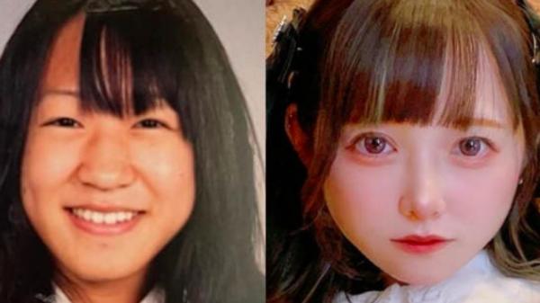 Operasi Plastik sejak Kelas 5 SD, Wanita Jepang Ini Habiskan Rp 1,1 Miliar