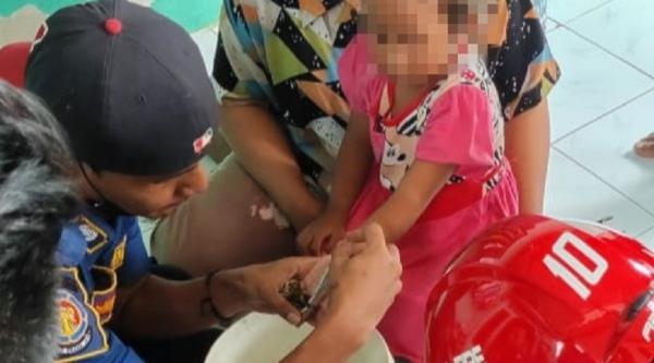 Jari Tangan Balita Terjepit Kunci Pintu, Damkar Turun Tangan