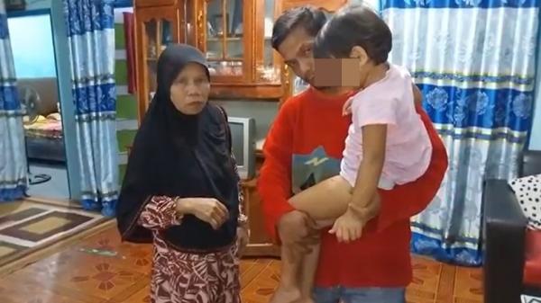 Bocah digigit anjing Bocah empat tahun di Bukittinggi, Sumbar, digigit anjing (Wahyu Sikumbanmg/MNC Portal)