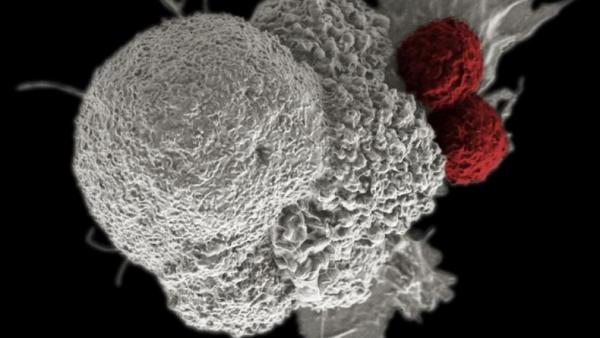 Pria hidup kembali setelah dinyatakan meninggal akibat komplikasi kanker oleh dokter rumah sakit. (Foto: Reuters)