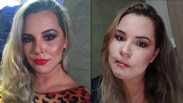 Tragis, Wajah Perempuan Ini Rusak akibat Filler Kecantikan malah Dilaporkan ke Polisi