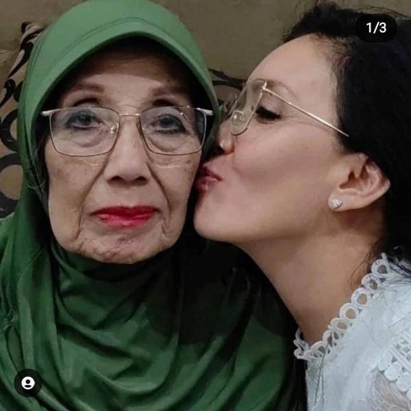 Artis Alami Pendarahan Otak. (Foto: instagram)