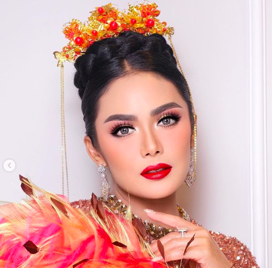 Artis lawas jalani operasi plastik mukanya berubah banget. (Foto: Instagram)