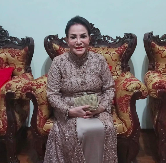 Artis lawas operasi plastik mukanya berubah banget. (Foto: Instagram)