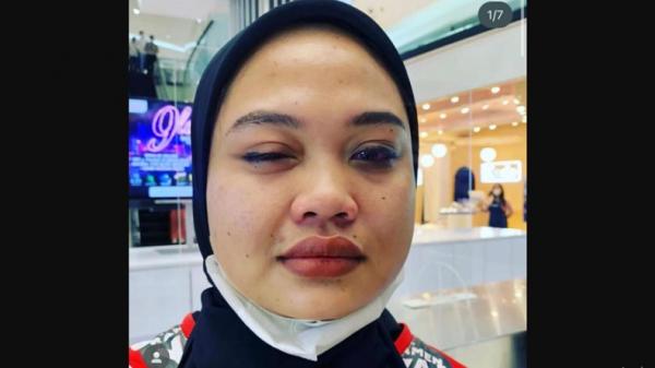 Viral Driver Ojol Pukul Karyawan Restoran di Jakbar, gegara Salah Ambil Orderan