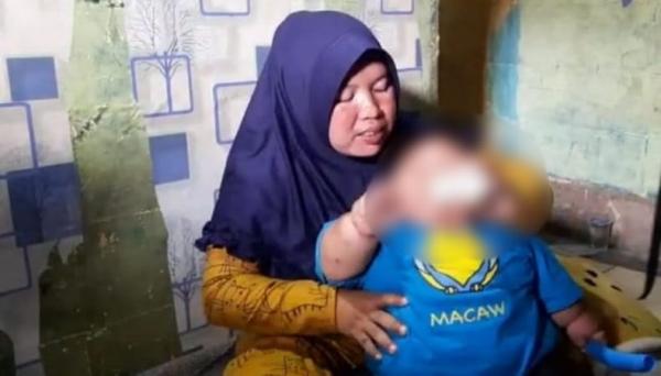 Balita di Bekasi Alami Obesitas, Berat Badan 27 Kg