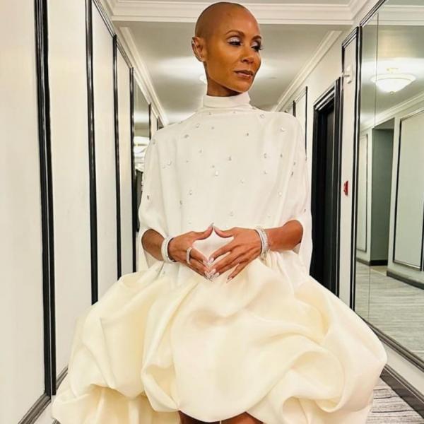 Artis Mengidap Autoimun. (foto: Instagram)