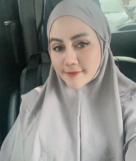 Artis menyesal setelah operasi plastik. (foto: Instagram)