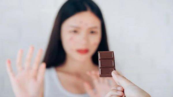 Benarkah Makan Cokelat Bikin Muka Jerawatan? Ini Faktanya