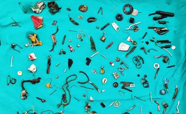 Barang-barang yang ditemukan dalam perut seorang pasien yang dibedah oleh tim dokter di sebuah RS di Kota Moga, Punjab, India. (Foto: Jam Press/Rare Shot News)