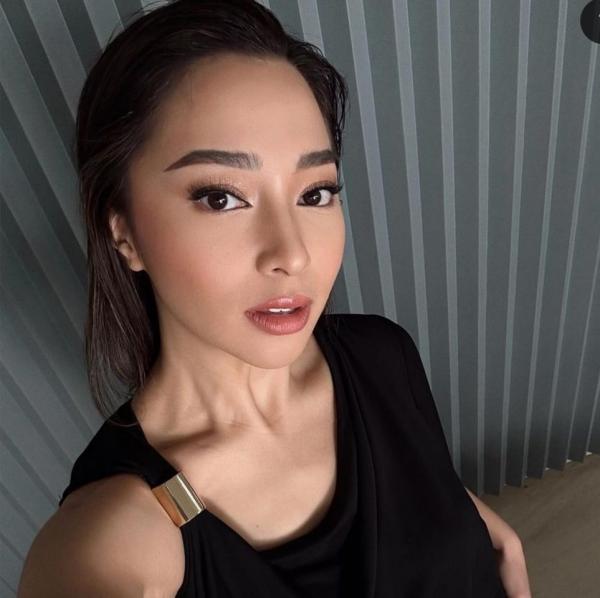 Artis cantik tetap percaya diri meski berjerawat. (foto: instagram)