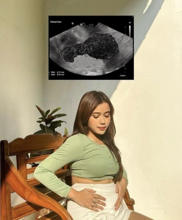 7FA83E48 B20C 4C6E 9299 E97886889122