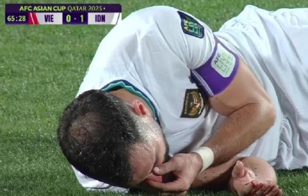 4 Pengorbanan Jordi Amat demi Timnas Indonesia, dari Kencing Darah hingga Patah Tulang 4 Pengorbanan Jordi Amat demi Timnas Indonesia, dari Kencing Darah hingga Patah Tulang