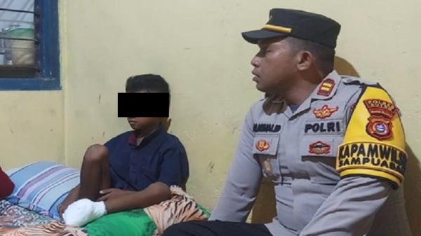 Kaki Bocah hingga Putus di Buton Putus Dibacok ODJG (Foto: iNews/Andhy Eba)