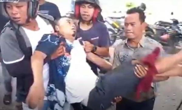 Salah satu pengunjung yang diserang kawanan ikan pari di Pantai Widuri, Pemalang. (Foto: iNews)