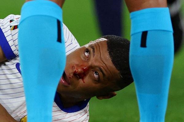 Penampakan Kylian Mbappe memakai topeng ala ninja usai patah hidung jadi perbincangan hangat Football Lovers. (Foto: Instagram/equipedefrance)