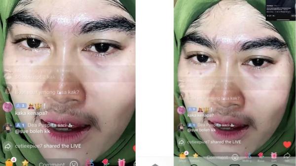 Viral Wajah Seorang Wanita Muncul Bulu Lebat di Wajah usai Pakai Skincare