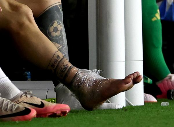 Ligamen engkel kaki kanan Lionel Messi mengalami cedera, dan belum diketahui kapan akan pulih. (Foto: REUTERS)