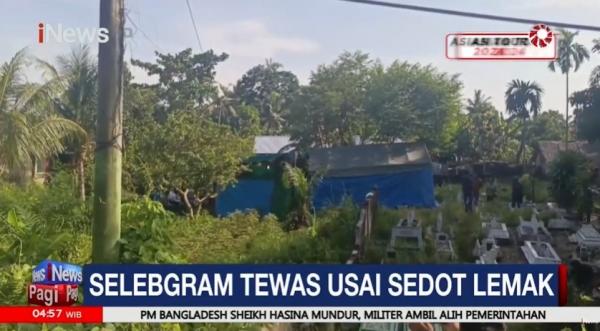 Polisi Bongkar Makam Selebgram Medan Yang Tewas Usai Sedot Lemak